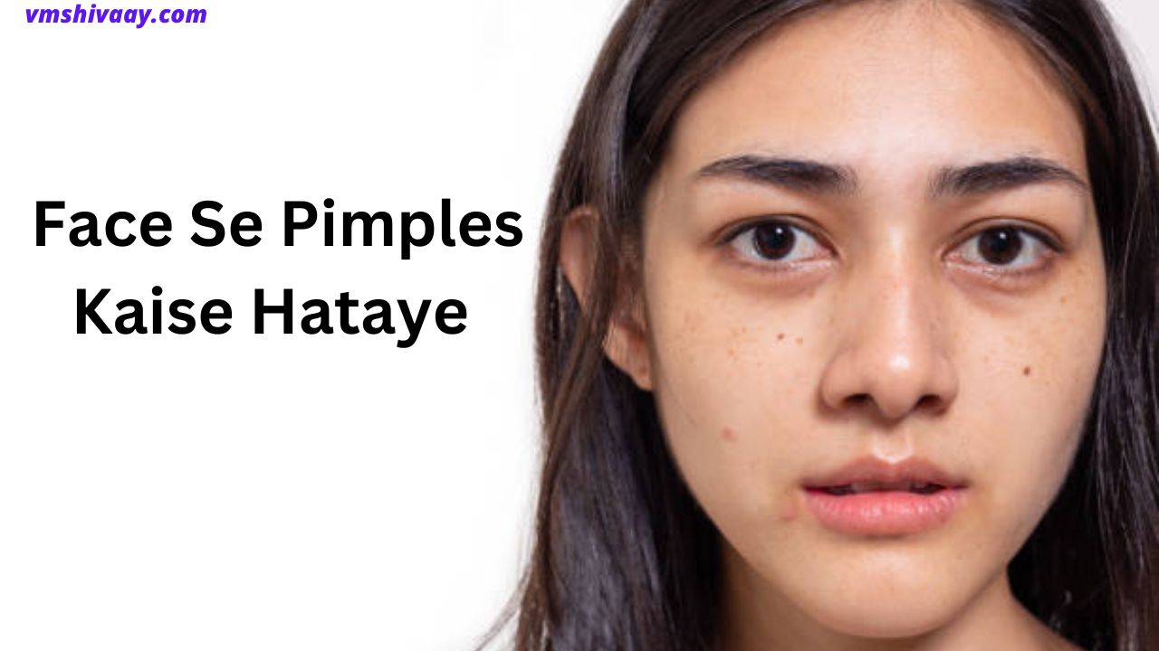 Face Se Pimples Kaise Hataye